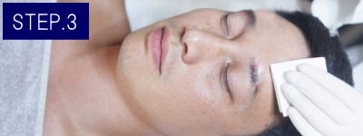 もみあげ脱毛Step3