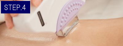 ひざ上脱毛Step4