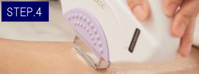 肩脱毛Step4