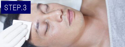 乳輪周り脱毛Step3