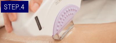 手の甲脱毛Step4