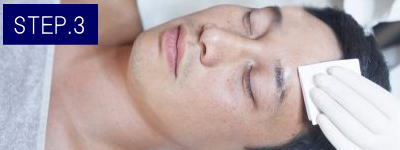 男性器脱毛Step3