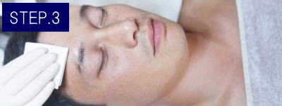 Oライン脱毛Step3